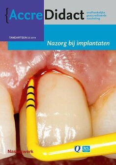 Nazorg bij implantaten | 9789089761620