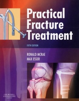 Practical Fracture Treatment | 9780443068768