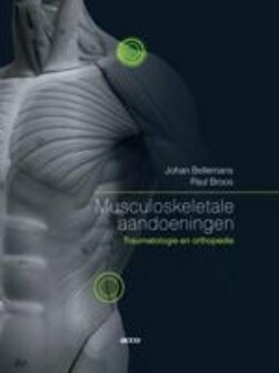 Musculoskeletale aandoeningen | 9789033471018