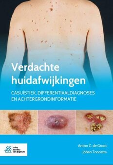 Verdachte huidafwijkingen | 9789036824668