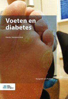 Voeten en diabetes | 9789036802789