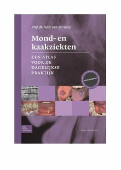 Mond- en kaakziekten | 9789036816328