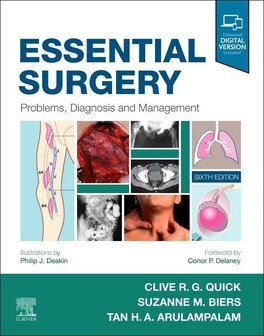 Essential Surgery | 9780702076312