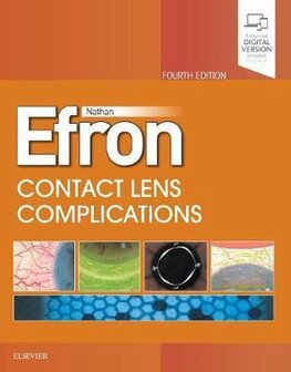 Contact Lens Complications | 9780702076114